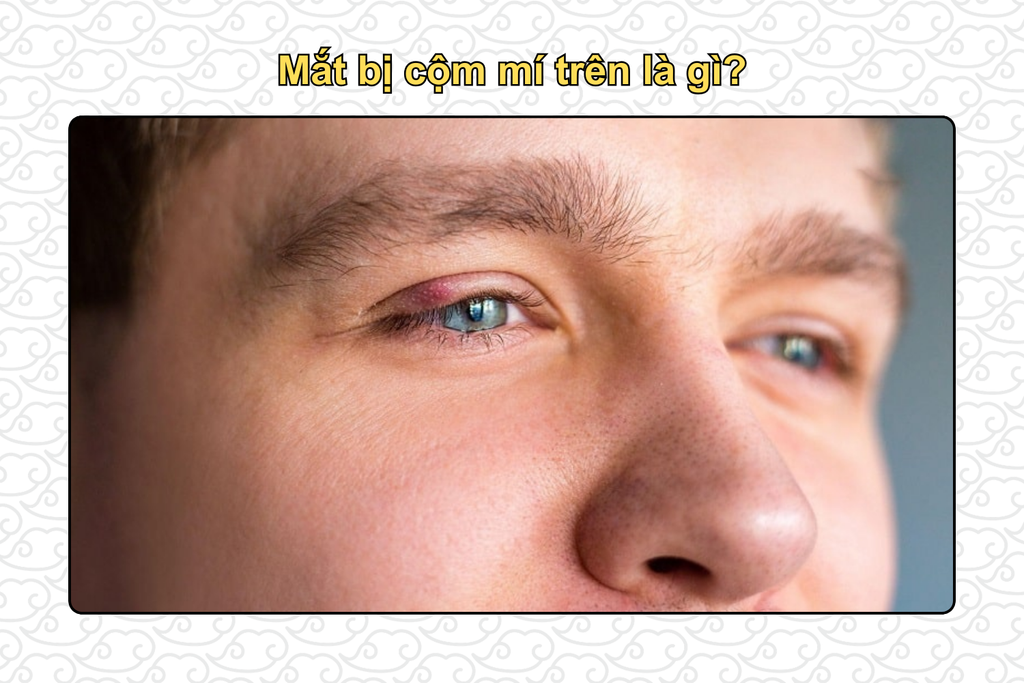 mat-bi-com-mi-tren-la-gi