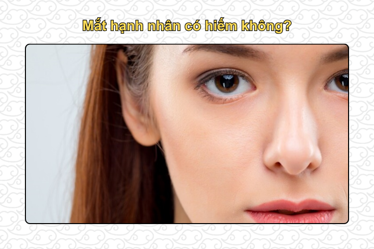 Mắt hạnh nhân có hiếm không?