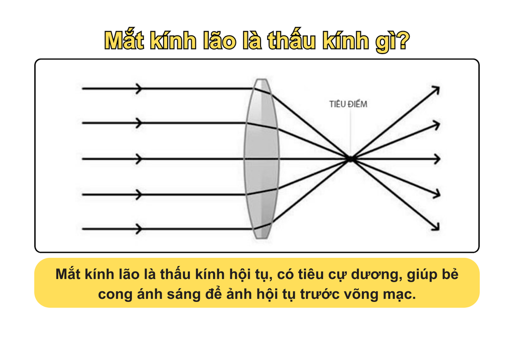 mat-kinh-lao-la-thau-kinh-gi