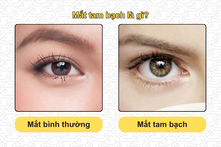 Mắt tam bạch là gì
