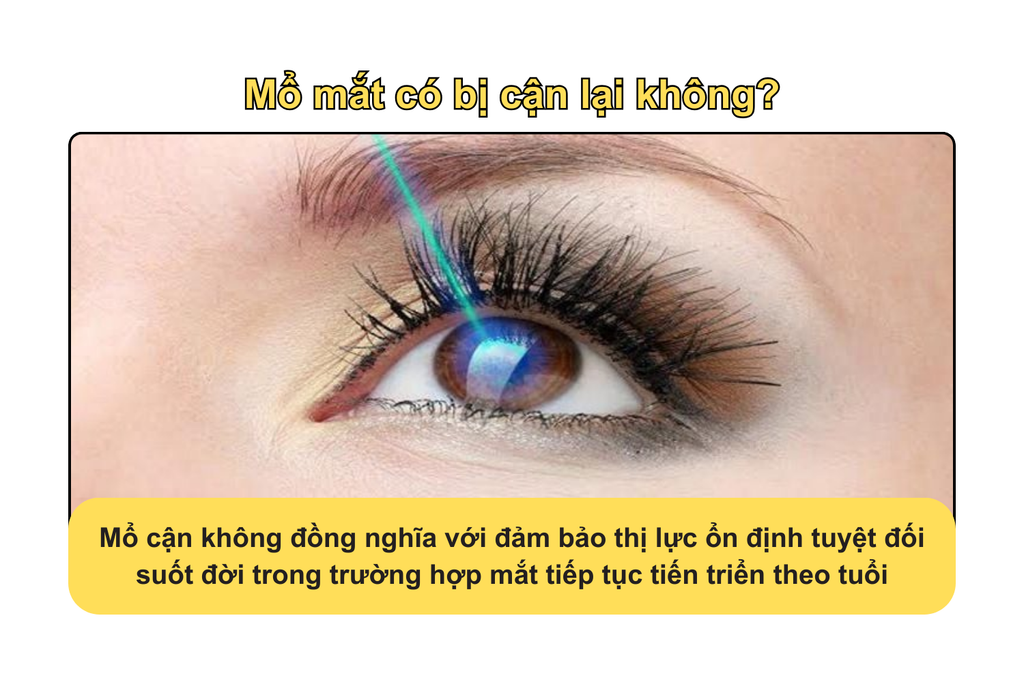 mo-mat-co-bi-can-lai-khong