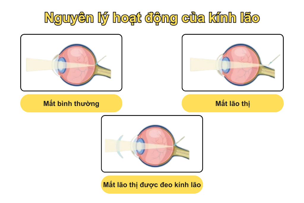 nguyen-ly-hoat-dong-cua-kinh-lao