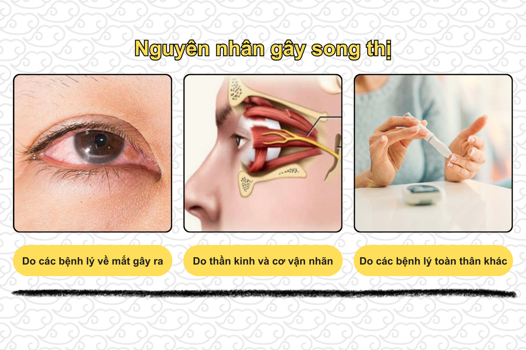 nguyen-nhan-gay-song-thi