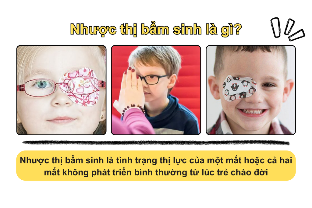 nhuoc-thi-bam-sinh-la-gi