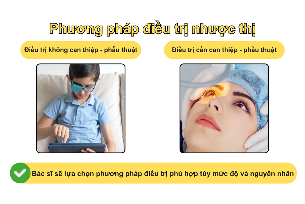 phuong-phap-dieu-tri-nhuoc-thi