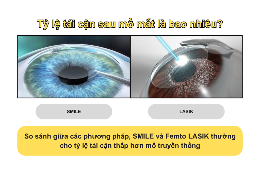 ty-le-tai-can-sau-mo-mat-la-bao-nhieu