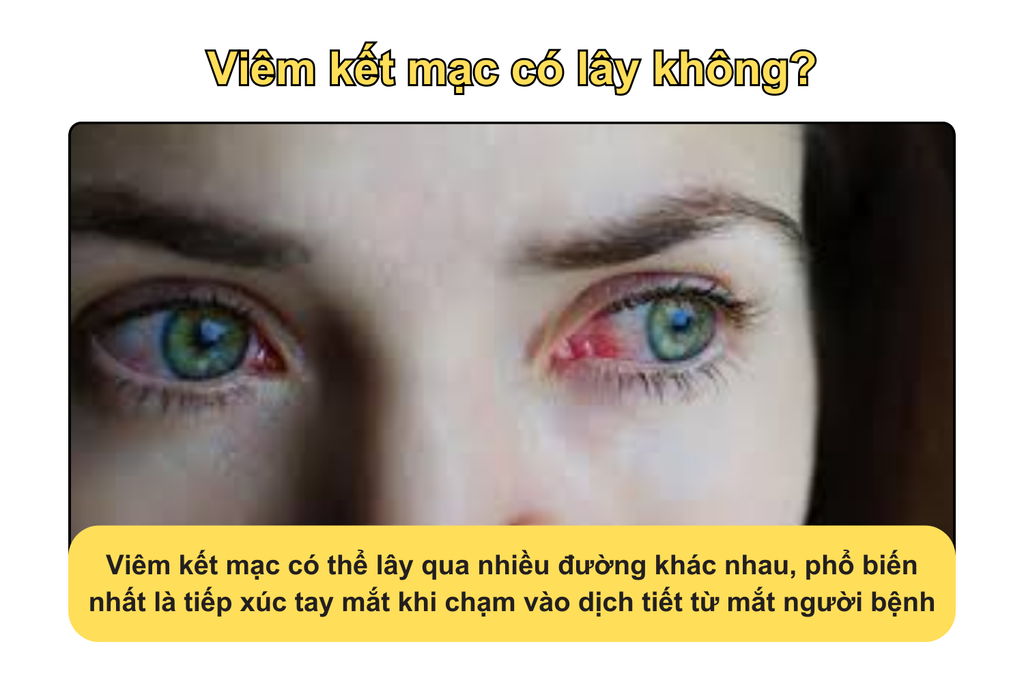 viem-ket-mac-co-lay-khong