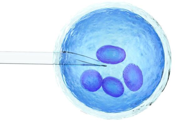 What Is Autologous Stem Cell Transplantation? ivfholymothers