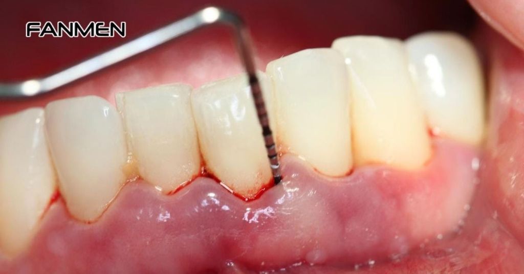 Tác động từ bệnh lý nha khoa