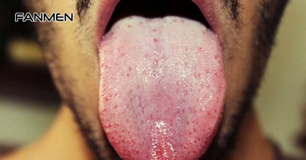 Mắc các bệnh lý