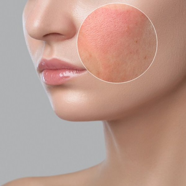 có nhiều thành phần dễ khiến da bị kích ứng