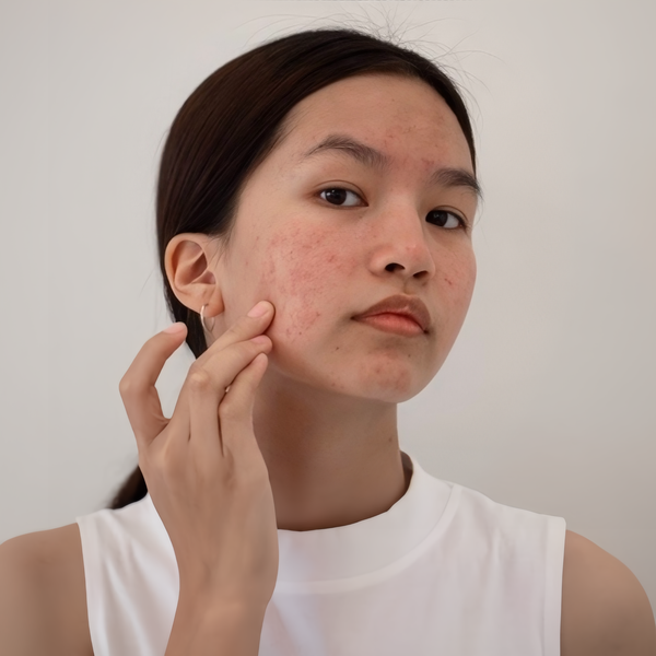 nên bôi kem dưỡng trắng da khi nào 2