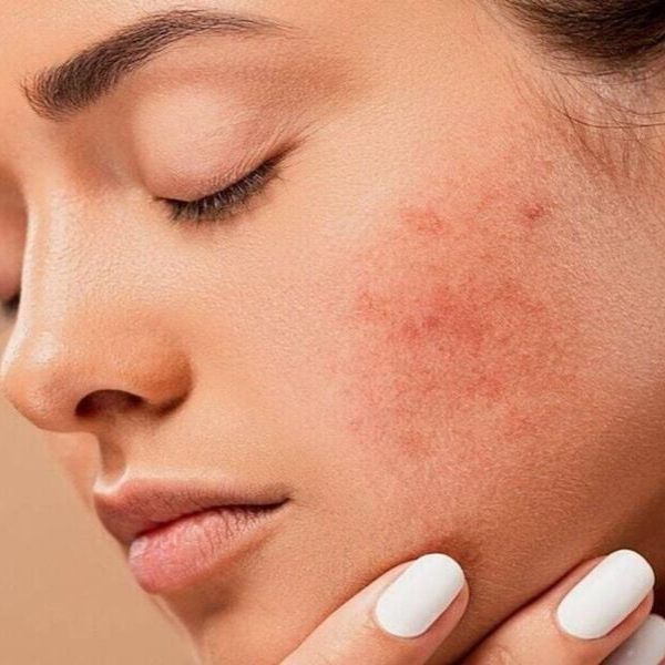 dấu hiệu nhận biết nước tẩy trang