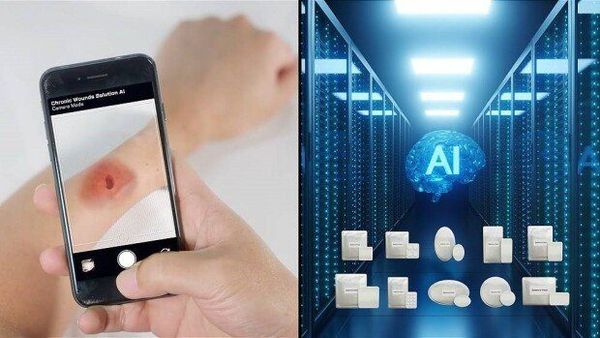 Curesilk chẩn đoán vết thương bằng ứng dụng AI