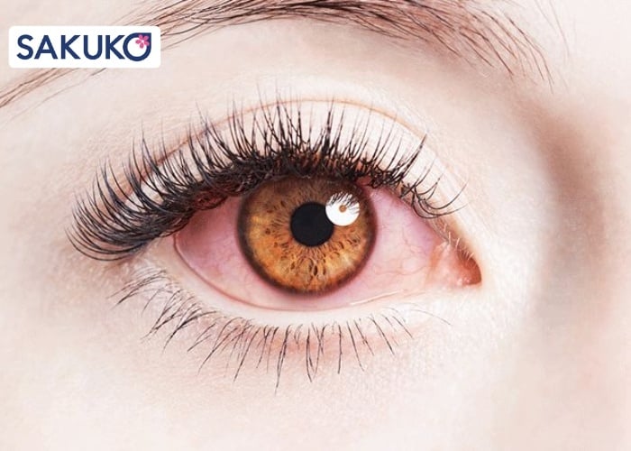 Hậu quả khi sử dụng phấn mắt đã hết hạn sử dụng