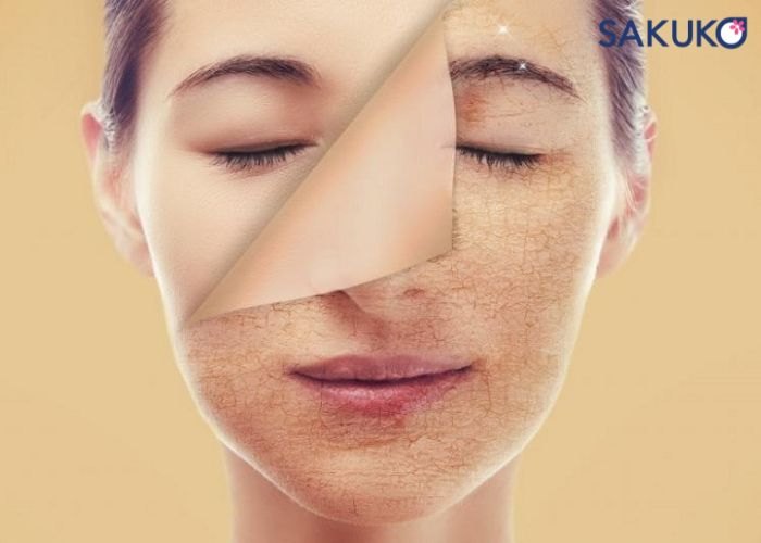 Những thay đổi của da mặt vào mùa đông