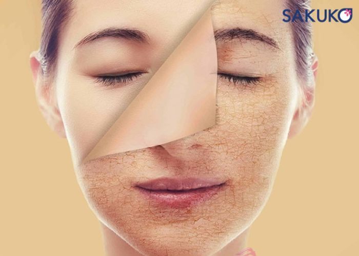 Cách dưỡng ẩm cho da mặt bị khô hiệu quả, an toàn