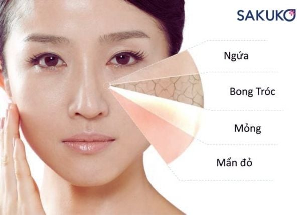 Vào mùa hanh khô làn da dễ gặp phải tình trạng căng rát, thiếu sức sống