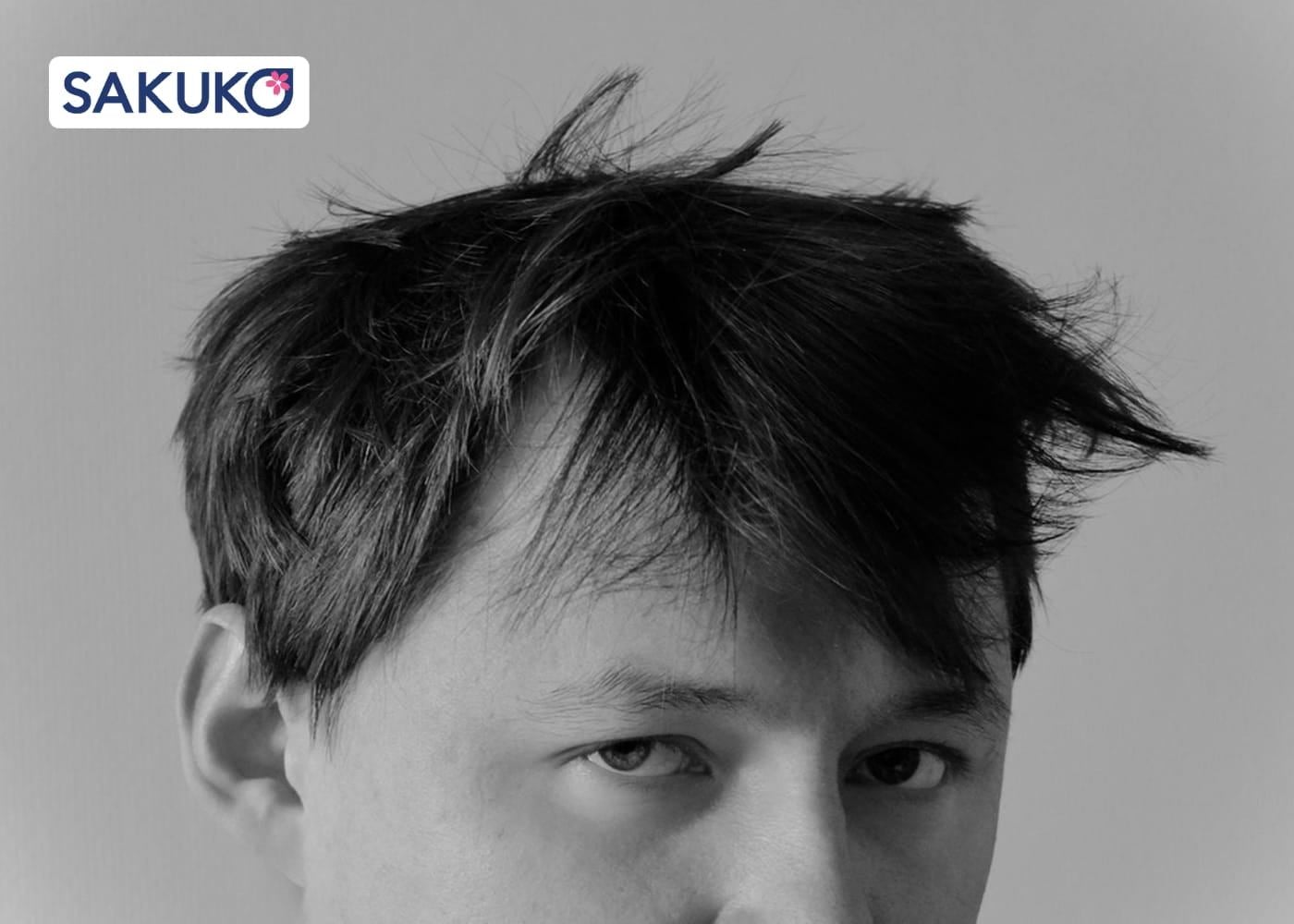 Tại sao tóc nam giới thường khô cứng và khó vào nếp?