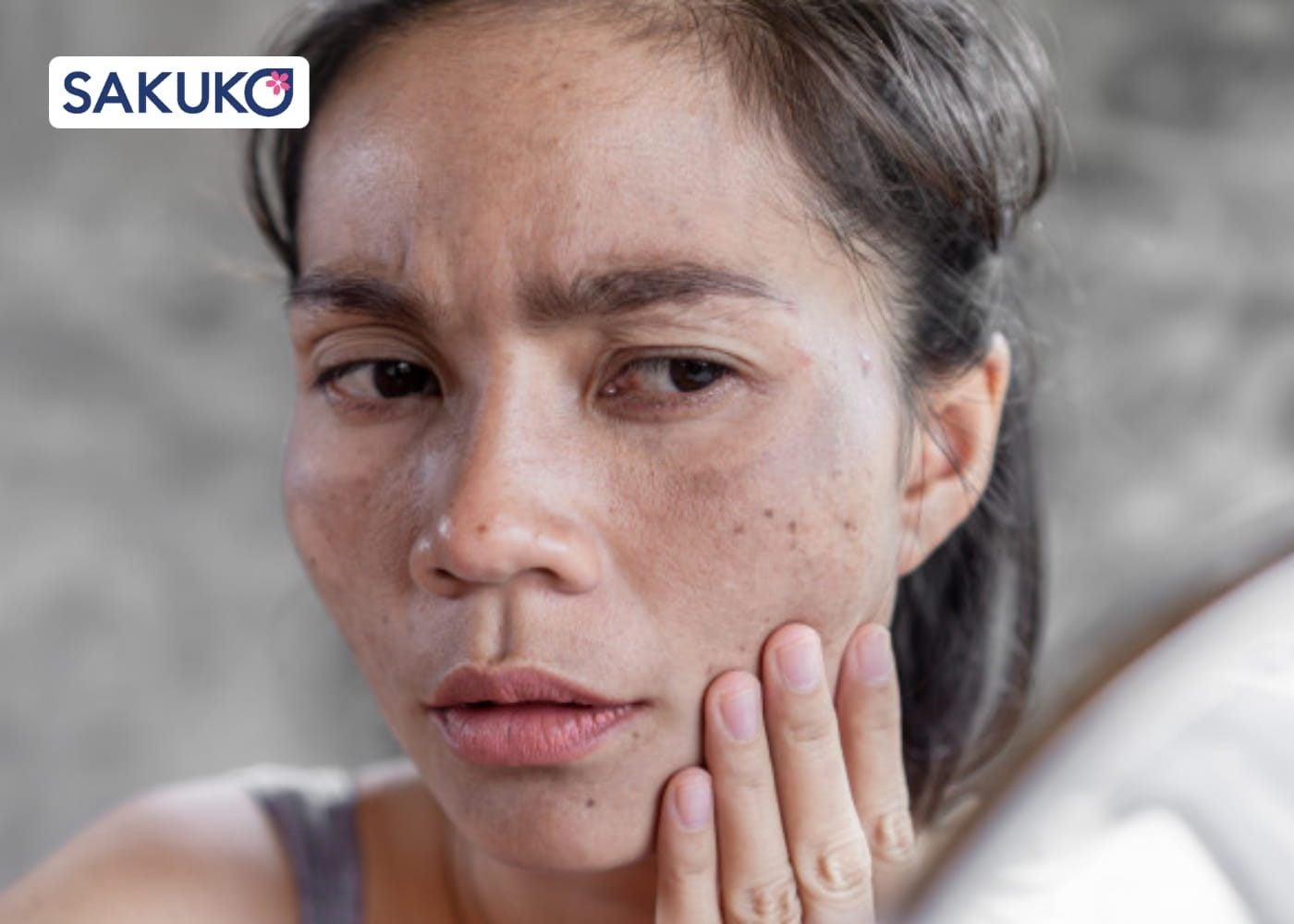 Hiểu về lão hóa da - 