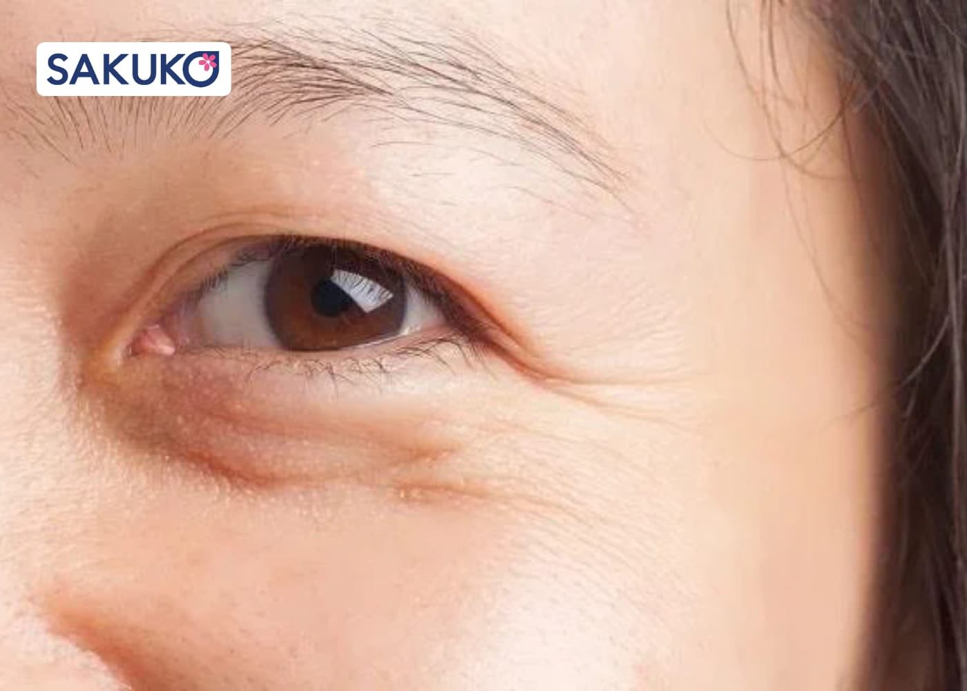 Hiểu về lão hóa da - 