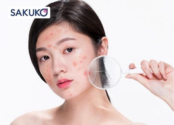 Các sai lầm khi dùng kem chống nắng