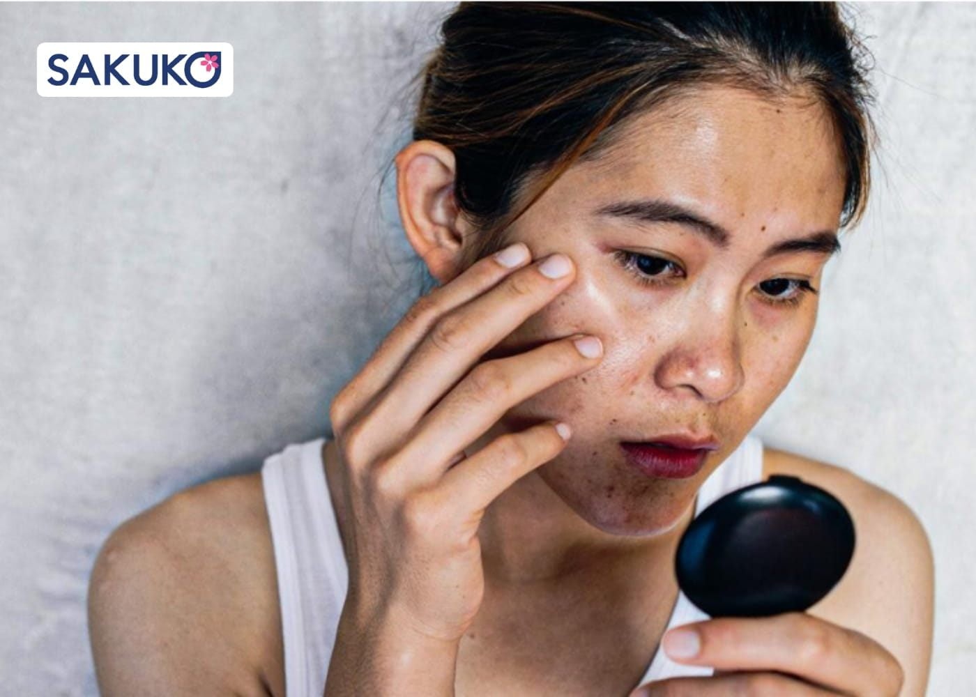 Nguyên nhân gây làn da xỉn màu, thiếu sức sống?