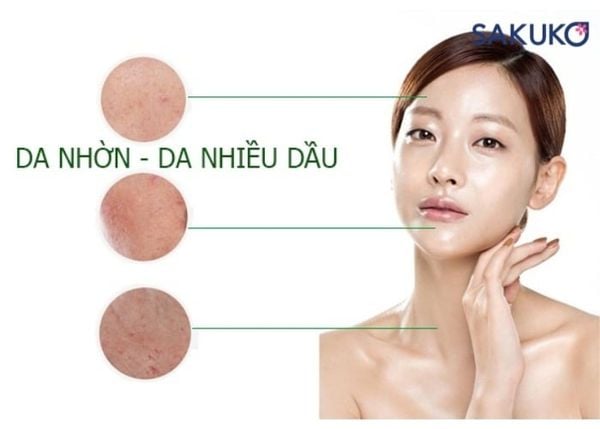 Đặc điểm của làn da dầu mụn