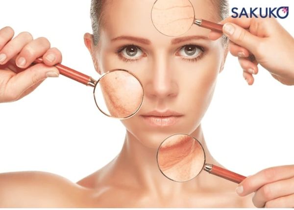 Da bị xỉn màu do tác động bên trong lẫn bên ngoài môi trường