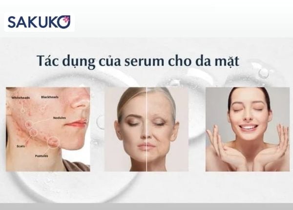 Công dụng của serum đối với làn da