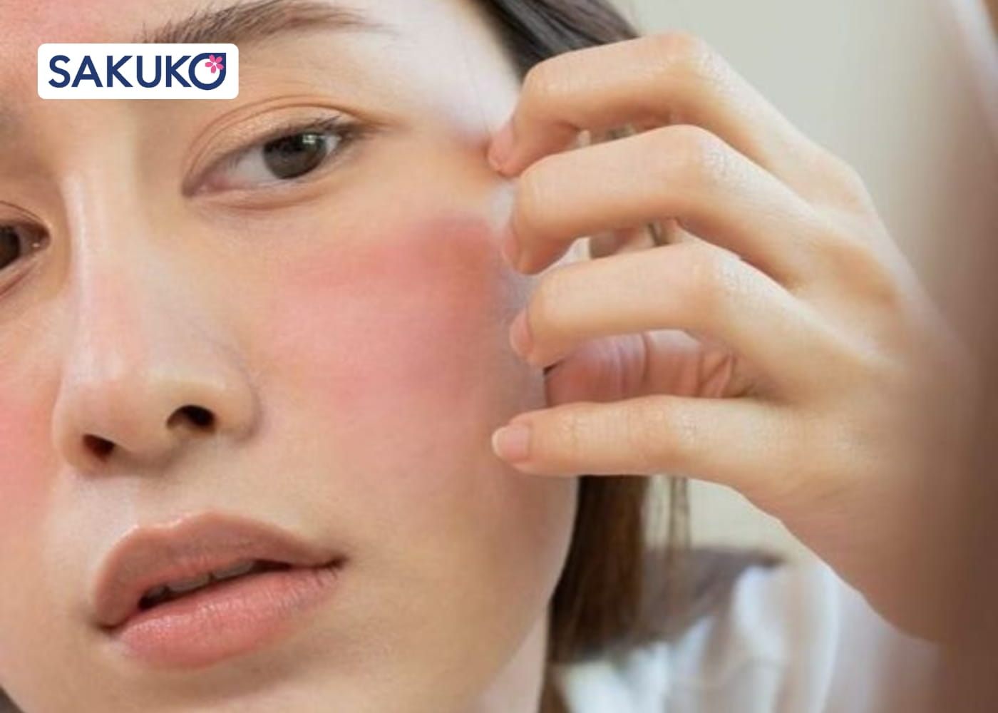 Kem chống nắng mặt dành cho da nhạy cảm