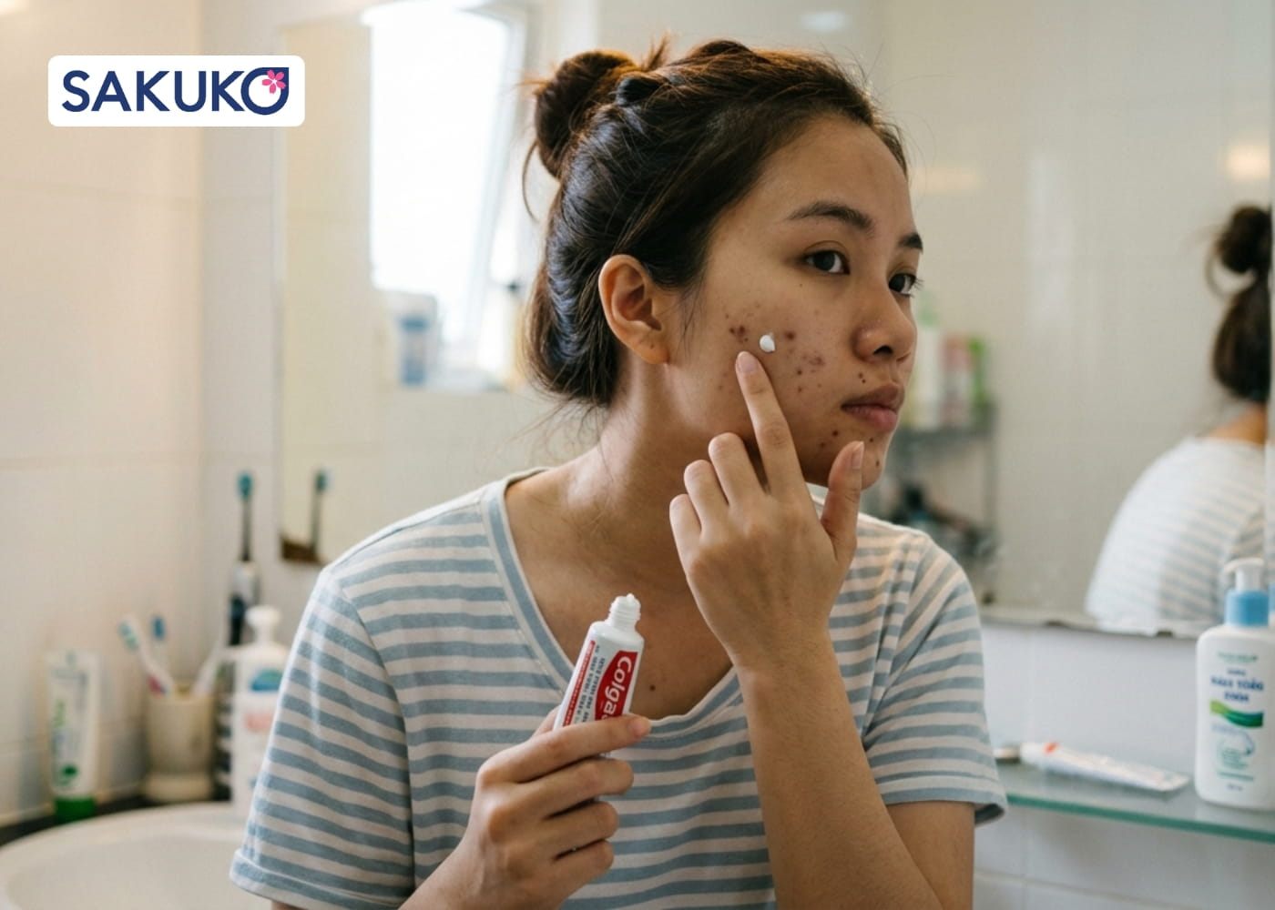 Chấm kem đánh răng lên&nbsp;đốm nâu/thâm mụn