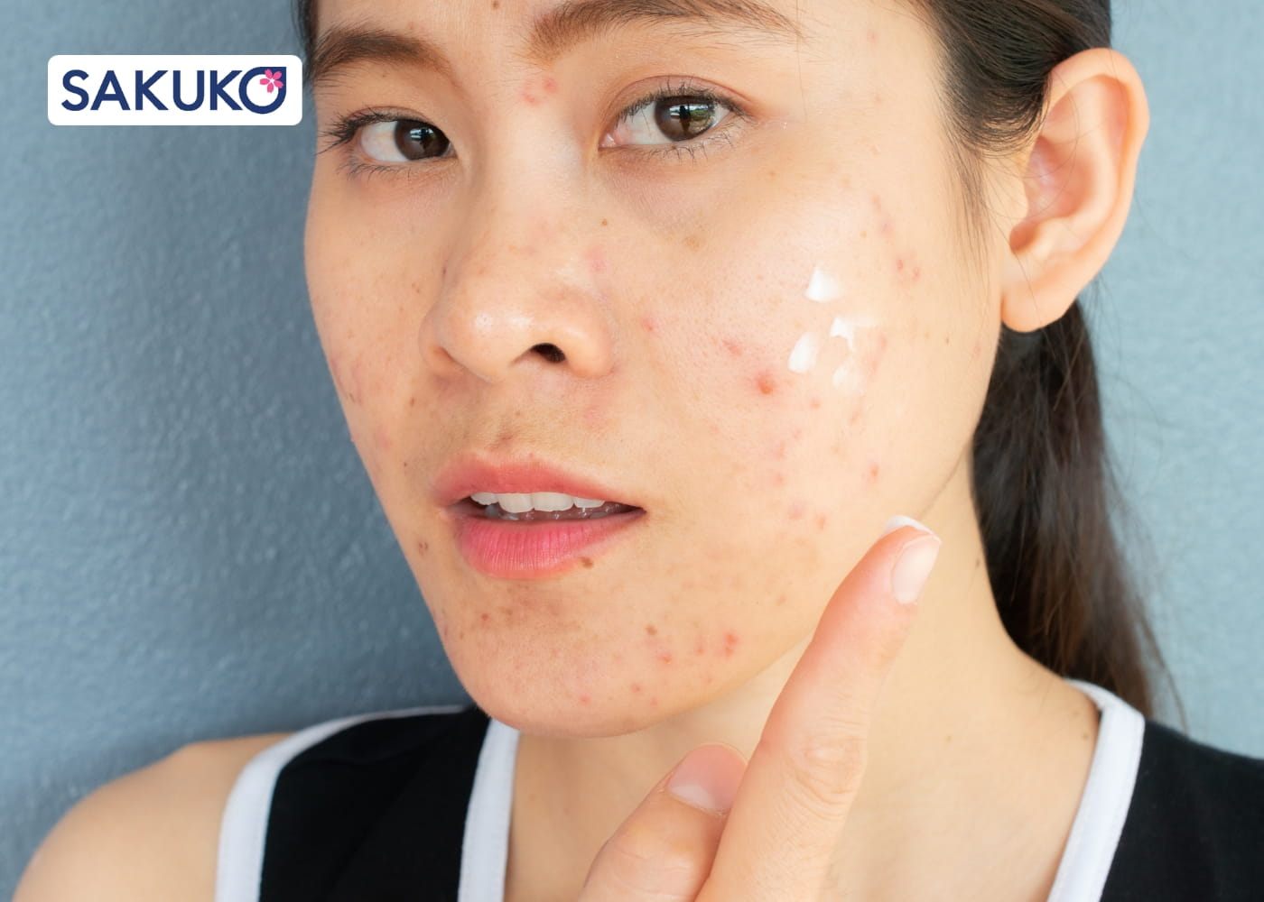 Những trường hợp cần lưu ý khi massage mặt