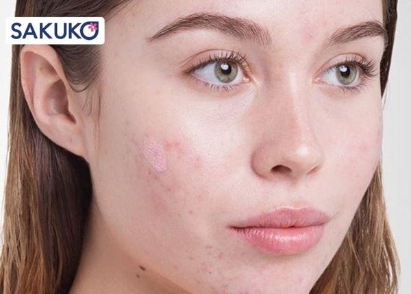 Phân loại mặt nạ theo từng tình trạng da thực tế