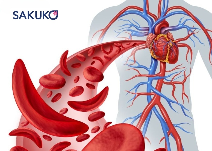 Các vấn đề về lưu thông máu