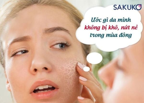 Da mặt bị khô hanh vào mùa đông