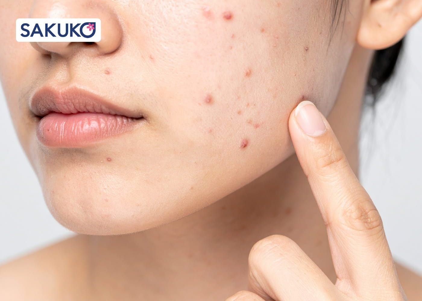 Kinh nghiệm tùy chỉnh routine skincare sáng&nbsp;theo từng loại da Cho làn da dầu và dễ nổi mụn