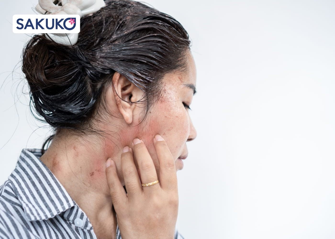 Kinh nghiệm tùy chỉnh routine skincare sáng&nbsp;theo từng loại da Cho làn da nhạy cảm