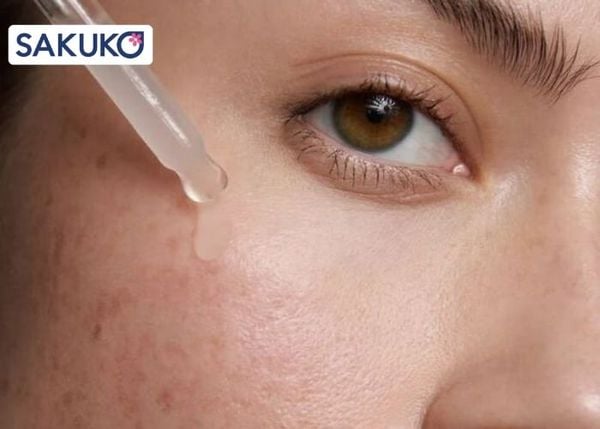 Nguyên nhân dẫn đến tình trạng dùng serum bị lên mụn