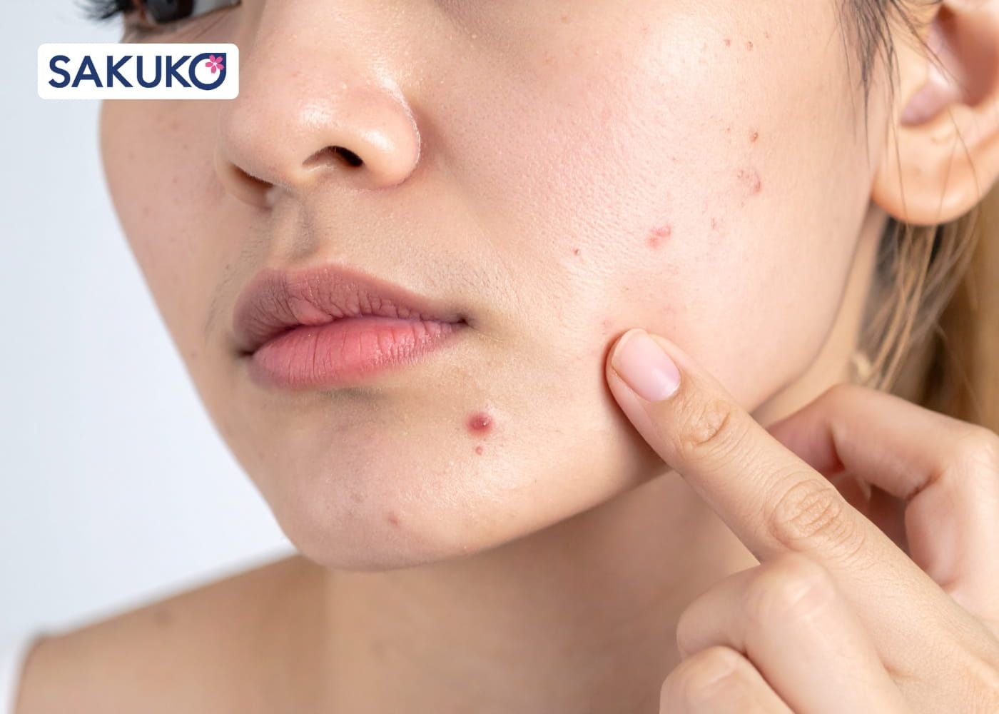 Tác hại khi dùng&nbsp;tẩy da chết Rosette fake, trôi nổi không chính hãng