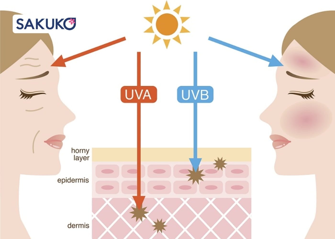 Các lý do gây ra tình trạng lão hoá da lão hoá ngoại sinh do tia UV
