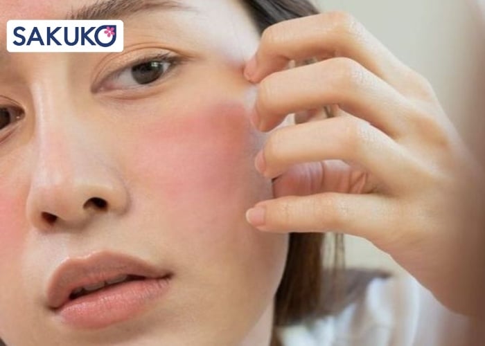 Phản ứng của làn da khi dùng sữa rửa mặt hết hạn