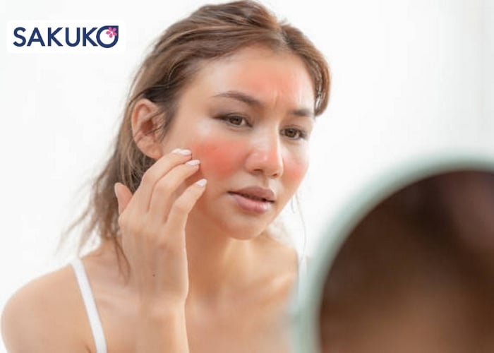 Dấu hiệu nhận biết làn da đang bị cháy nắng