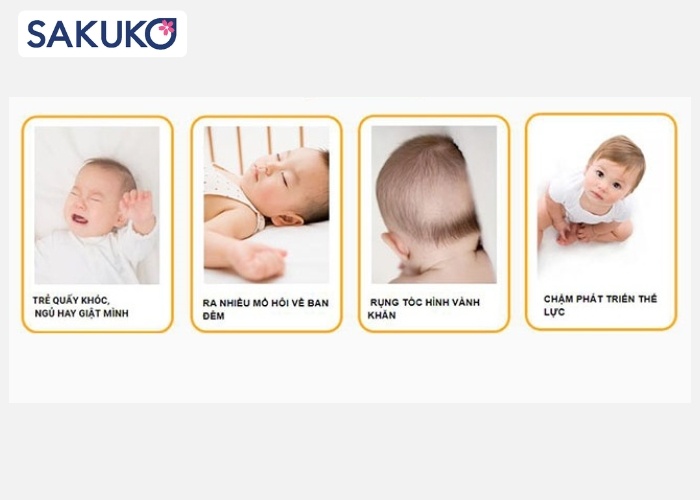 Cách nhận biết bé đang thiếu vitamin D3K2