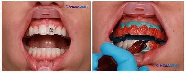 Banh miệng Umbrella 1