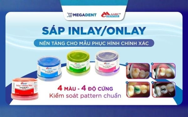 Sáp Inlay Onlay 200g – Kiểm soát pattern phục hình