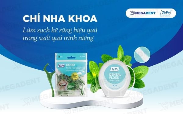 Chỉ nha khoa – Làm sạch kẽ răng hiệu quả khi niềng răng