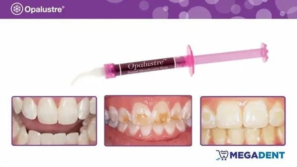 Opalustre - Chất xử lý đốm trắng