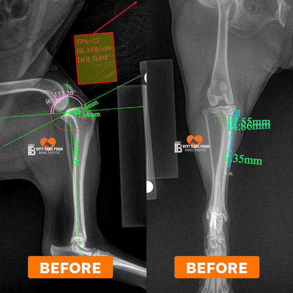 đứt dây chằng chéo trước