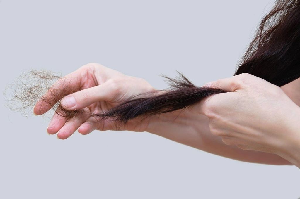 Tình trạng rụng tóc đã trở nên phổ biến với cả người trẻ tuổi (Nguồn ảnh: Internet)